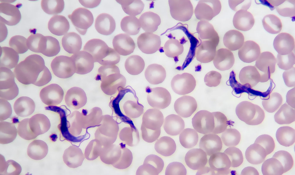 śpiączka afrykanska